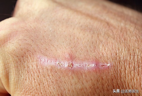 维生素e软胶囊药用和保健区别,维生素e怎么用食物补充