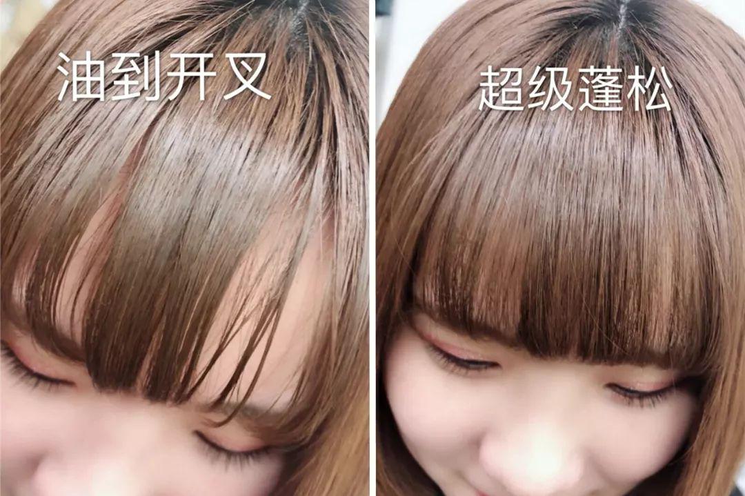 去头屑去螨虫哪个洗发水最有效,去头屑去螨虫用哪个洗发水最有效