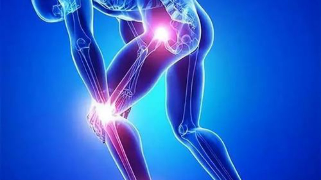 粘多糖储积症是隐性遗传病，一共有7种类型，多由基因变异导致