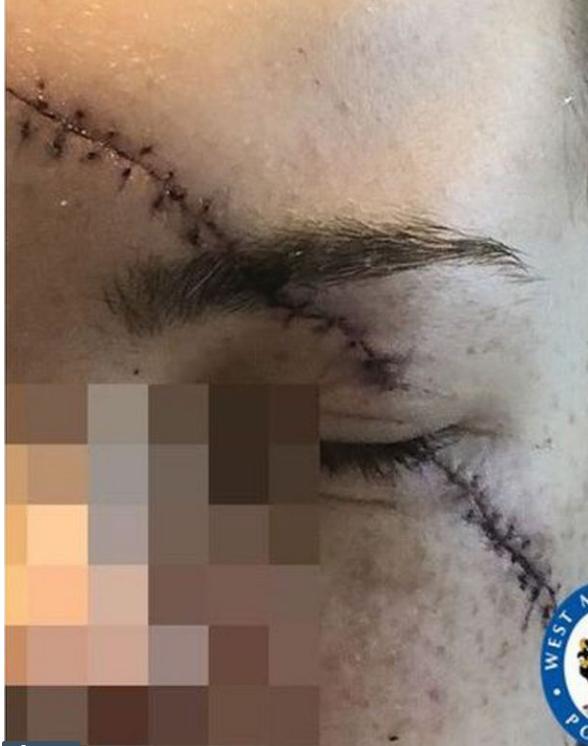 女子被割伤后续,英国女子被刺11刀