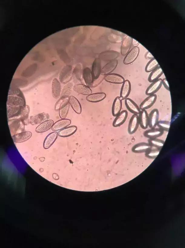 宝宝屁股痒怎样止痒,宝宝屁股痒如何止痒快