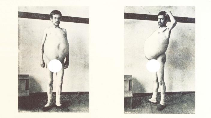 爱因斯坦的大脑在哪个博物馆,爱因斯坦的大脑为科学奉献一生