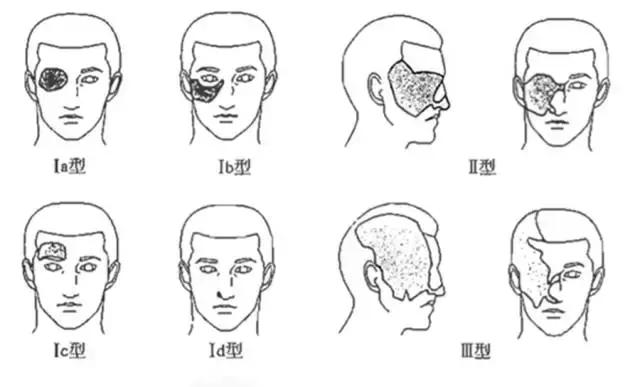 面对百「斑」刁难，你该如何反击......