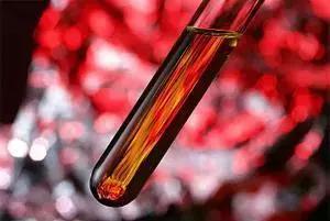 肌酐高对痛风有影响吗,疼痛会导致肌酐高