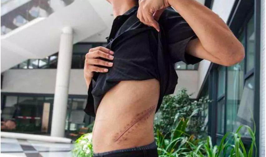 10年前卖肾少年卖苹果手机,当年卖肾换苹果4的男孩怎么样了
