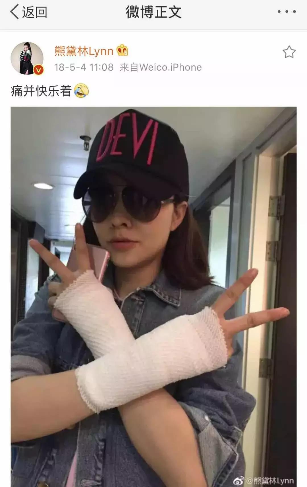 治疗腱鞘炎手腕最快的恢复办法,抱孩子容易得腱鞘炎