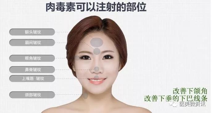 肉毒素怎么去皱原理是什么,肉毒素眼部祛皱多久打一次