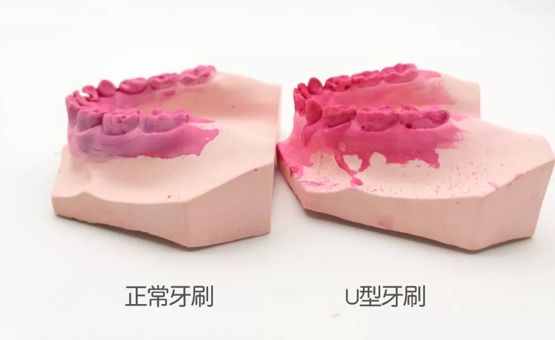 儿童u型牙刷评测,儿童刷牙神器u型牙刷