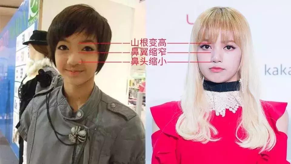 lisa如今的变化,lisa前后颜值对比