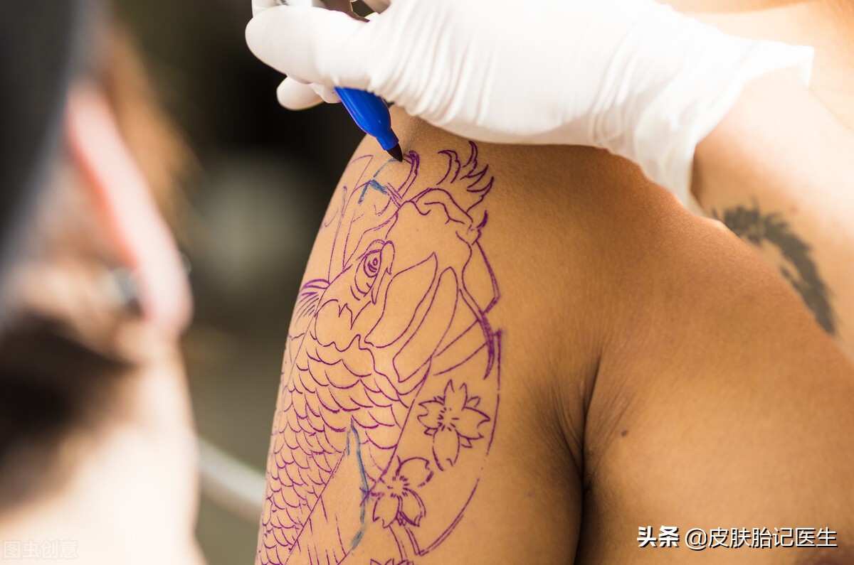 有什么好的办法去除纹身不留疤,什么方法可以把纹身去干净