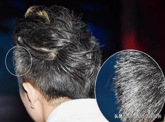 为什么有人年纪轻轻就有白发,为什么年纪轻白发增多