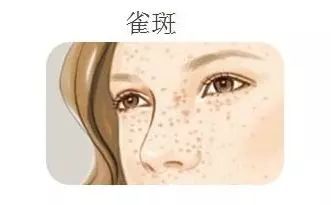 再美的脸，也抵挡不住“加斑”的困扰