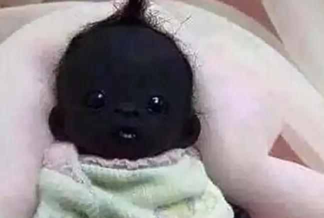 世界上最黑的女婴是谁,最黑的婴儿现在怎样了