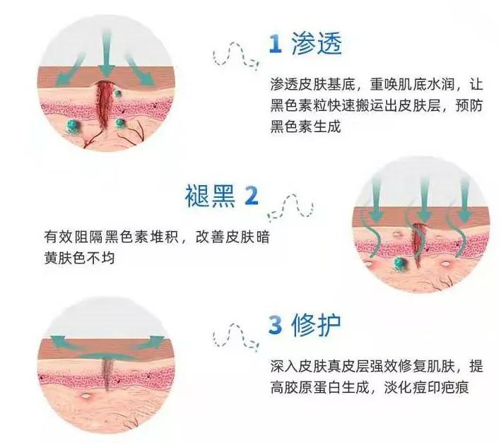 北京看痘痘好的皮肤科医院,去皮肤科看痘痘好不好