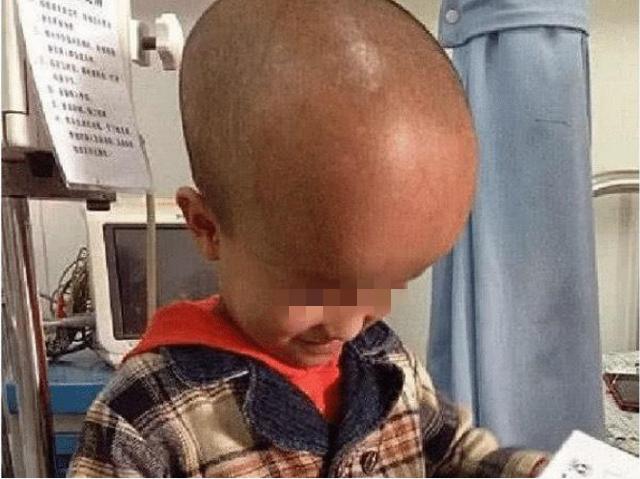 揭露三鹿奶粉的人最后怎么样了,13年前喝三鹿奶粉的孩子都怎么了