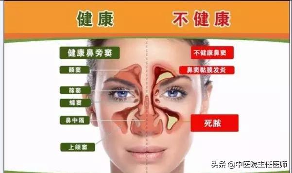 鼻窦炎引发的头疼严重吗,鼻窦炎发展到什么程度会引起头疼