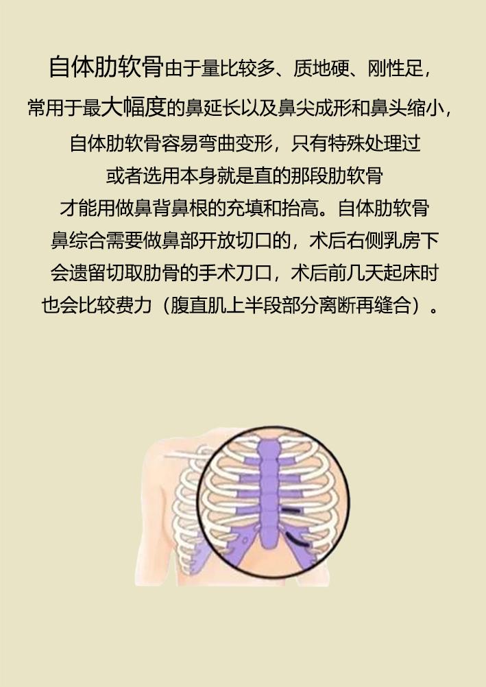 鼻整形之路,鼻整形拯救不完美鼻子的救星