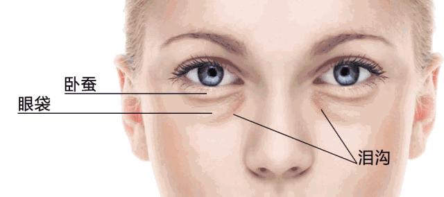 为什么眼睛大会显老？黑眼圈、眼袋、眼纹怎么去除？这两招就够了