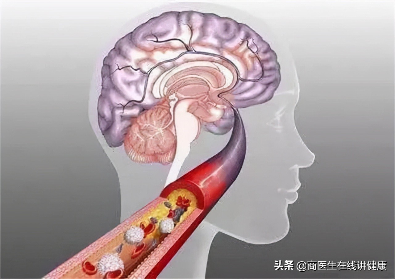 血糖高胰岛素高能吃什么水果,血糖高吃什么水果可以产生胰岛素