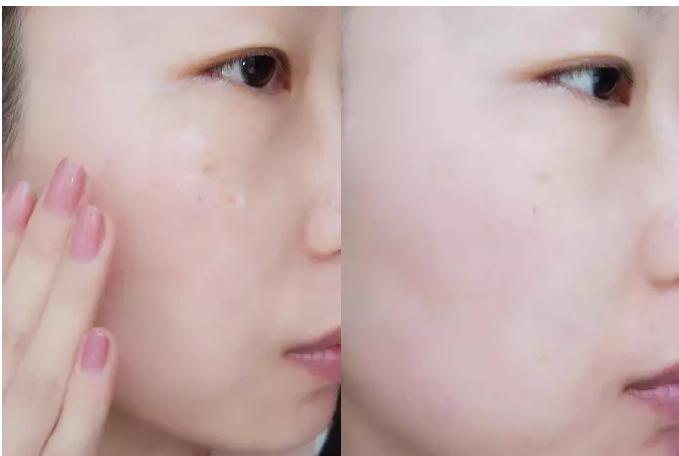 国外大牌虾青素精华,新西兰虾青素水光肌精华