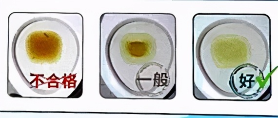 胃镜肠镜检查前的准备,做肠镜检查前做什么准备