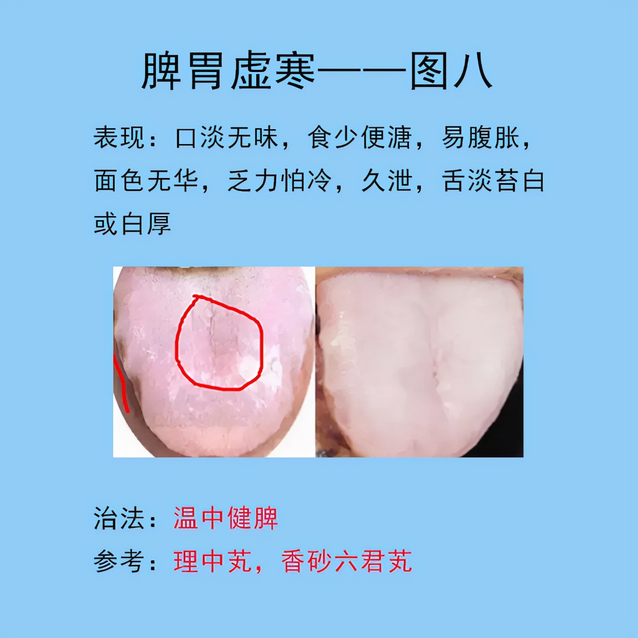 根据舌象判断用哪种调理脾胃的药,脾胃常见的症状