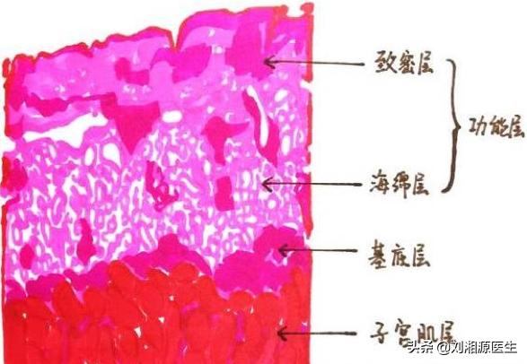 免疫治疗不良妊娠的方法,宫腔粘连合并妊娠
