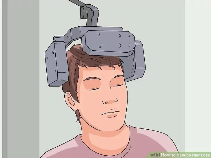 减少脱发的洗发水,脱发毛囊减少