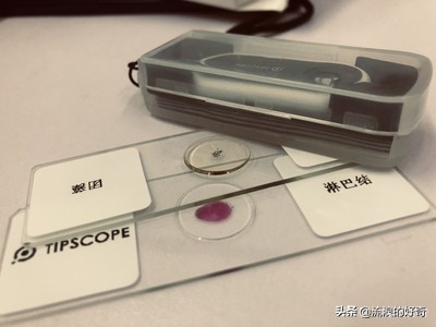 oppofindx3pro显微镜拍螨虫,oppofindx3显微镜可以看螨虫吗