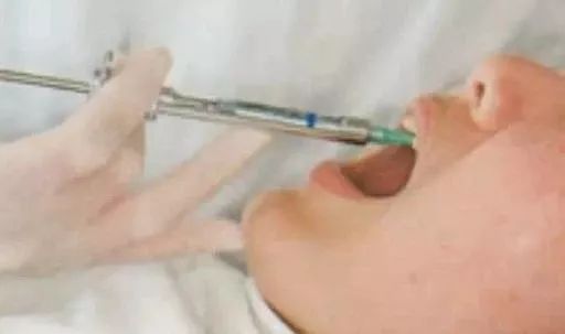 拔智齿是怎么算收费的,拔智齿是按智齿个数收费吗