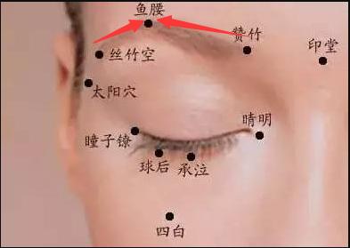 视神经萎缩针灸可以提高视力吗,视神经萎缩针灸部位图解