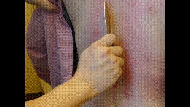 刮痧肝胆经心包经视频,刮痧大腿两侧的胆经