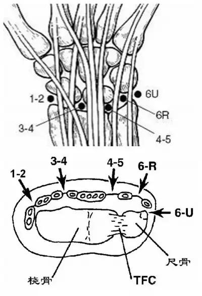 手腕囊肿抽吸出来后可否继续按压,足背囊肿穿刺好还是切除好