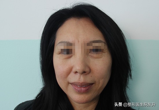 眼袋大用什么化妆品能修复,眼袋大怎么办用什么护肤品好