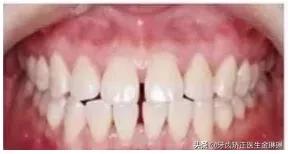 淄博诺尔曼齿科种牙怎么样,淄博诺尔曼齿科整牙费用