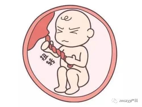 教你如何数胎动,怎么数胎动教你4个小方法