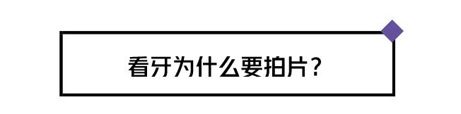 看牙不拍片直接说费用,医院看牙拍片贵吗
