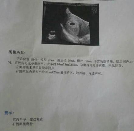 停经20天左小腹难受流血,停经6天小腹痛是怎么回事