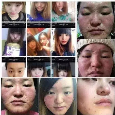 21亿智商税？屡遭质疑的微商面膜如此赚钱！林志玲陶虹都陷入了