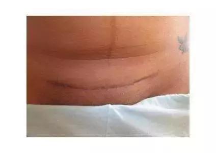 世上最丑的“微笑”……你不喜欢拥有它，但它的伟大无可否认！