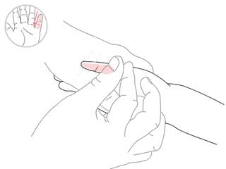 感冒是寒包热用什么偏方治好,寒包火感冒最有效的药