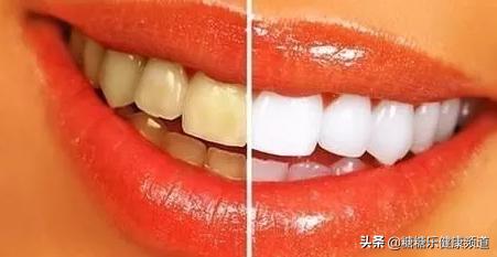 教你如何快速美白牙齿效果显著,大神教你一招美白牙齿
