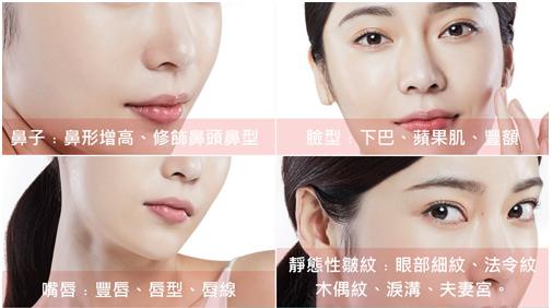 注射玻尿酸属于什么医美技术,注射玻尿酸国产和进口有什么差别