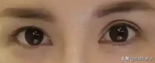 微整形需要多久,最受欢迎的5大微整形