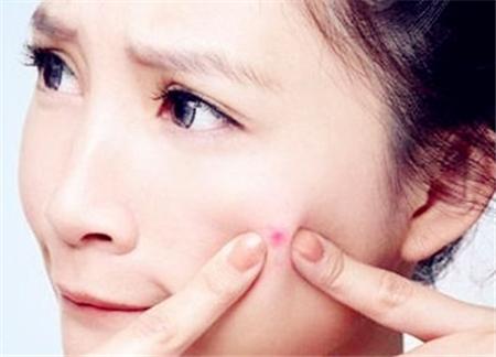 脸上起小痘痘怎么办医美,医美脸上长痘坑坑洼洼的怎么修复