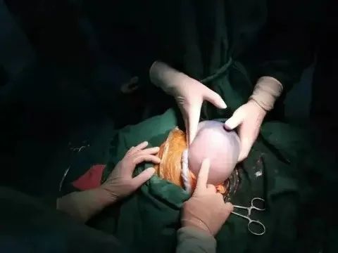 妈妈生下四胞胎爸爸急哭了,妈妈生下双胞胎儿子爸爸绝望