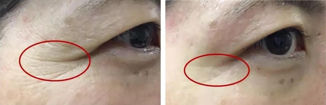 国外大牌虾青素精华,新西兰虾青素水光肌精华