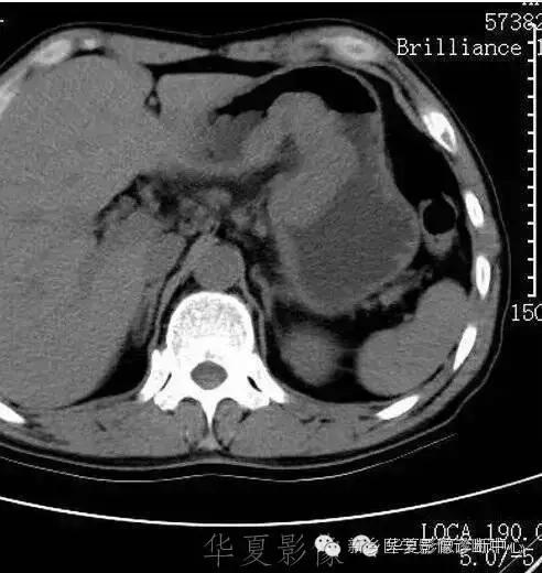 这些部位的黑色素瘤，您会诊断吗？