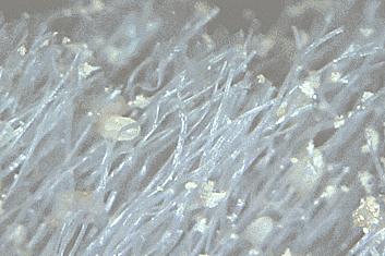 头皮痒螨虫成千上万,头皮痒是病的前兆螨虫作怪吗