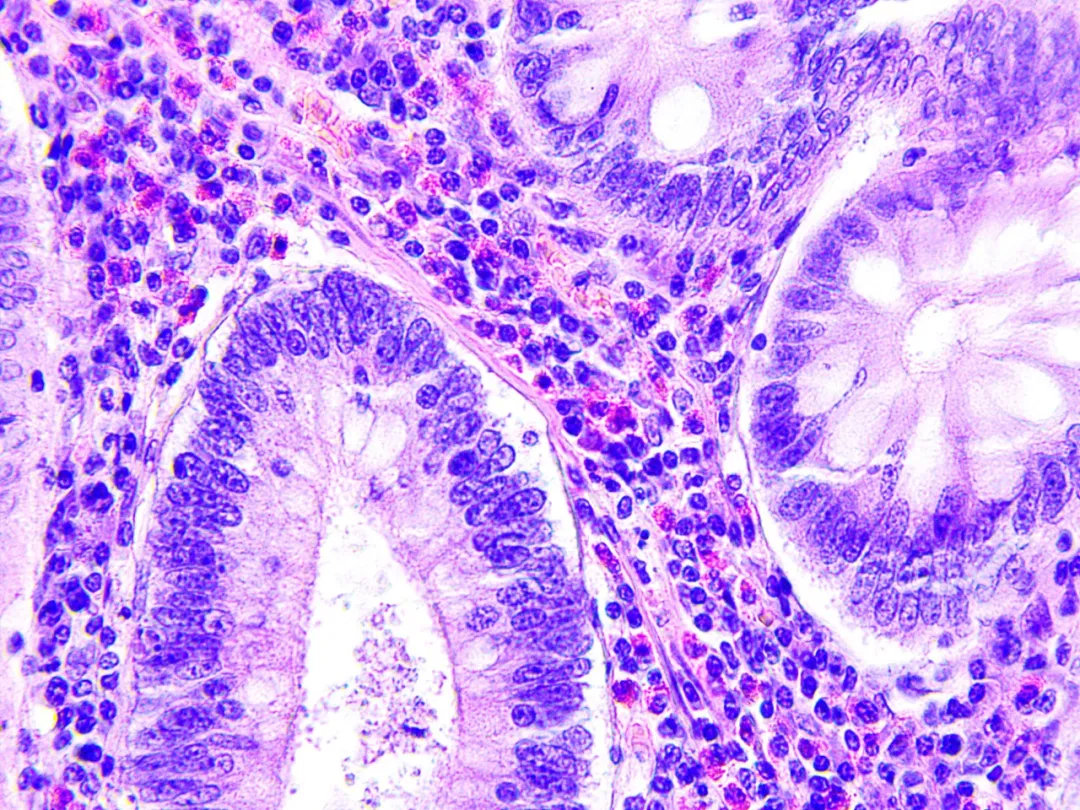 快讯｜科学家利用胎盘干细胞来治疗早产儿结肠炎等多种疾病